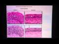 Transitional Epithelium